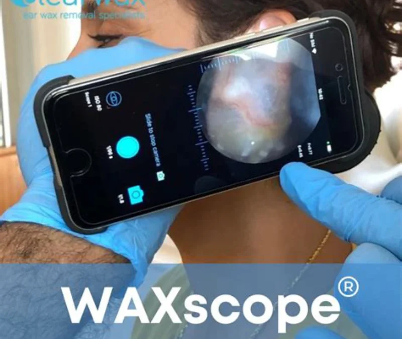 Waxscope